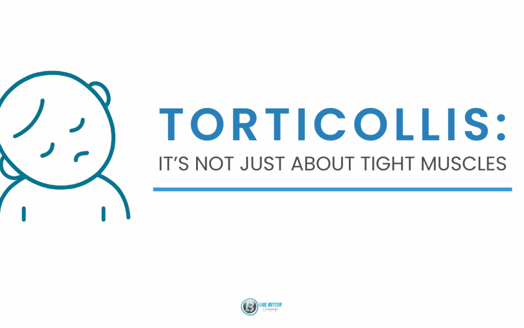 The Real Reason Stretching Isn’t Fixing Your Baby’s Torticollis