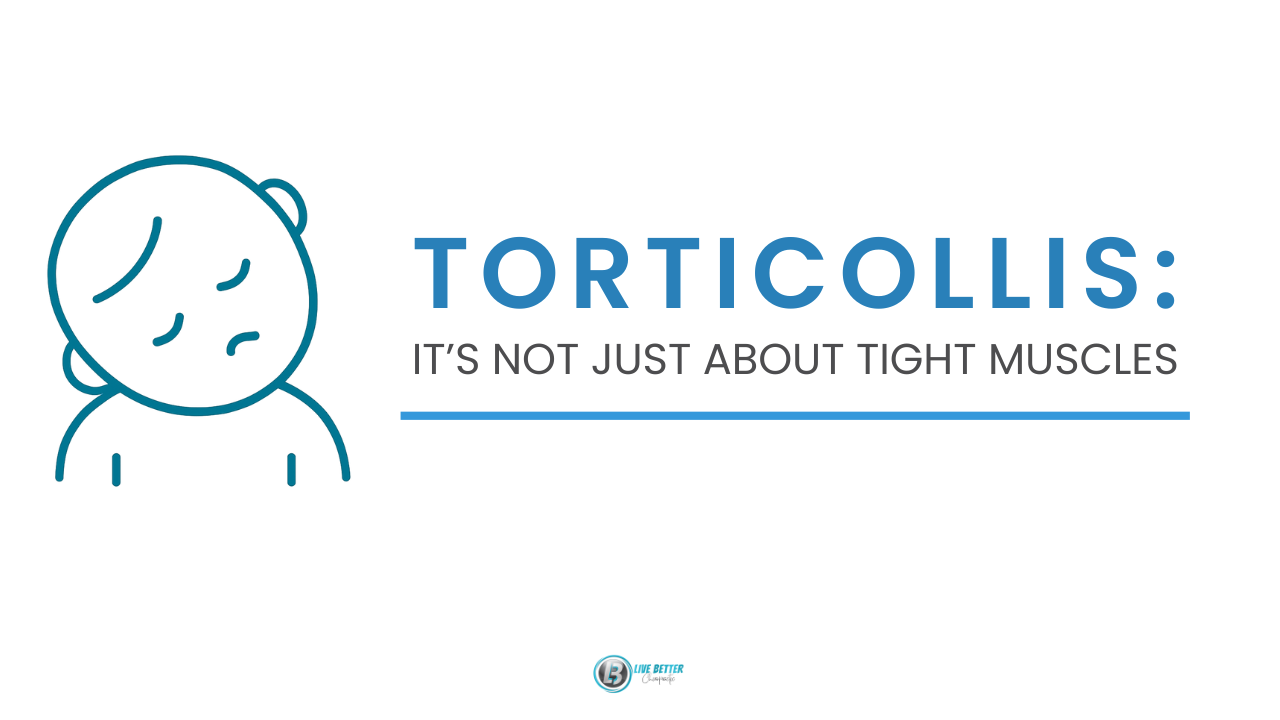 LBC-Featured-Torticollis